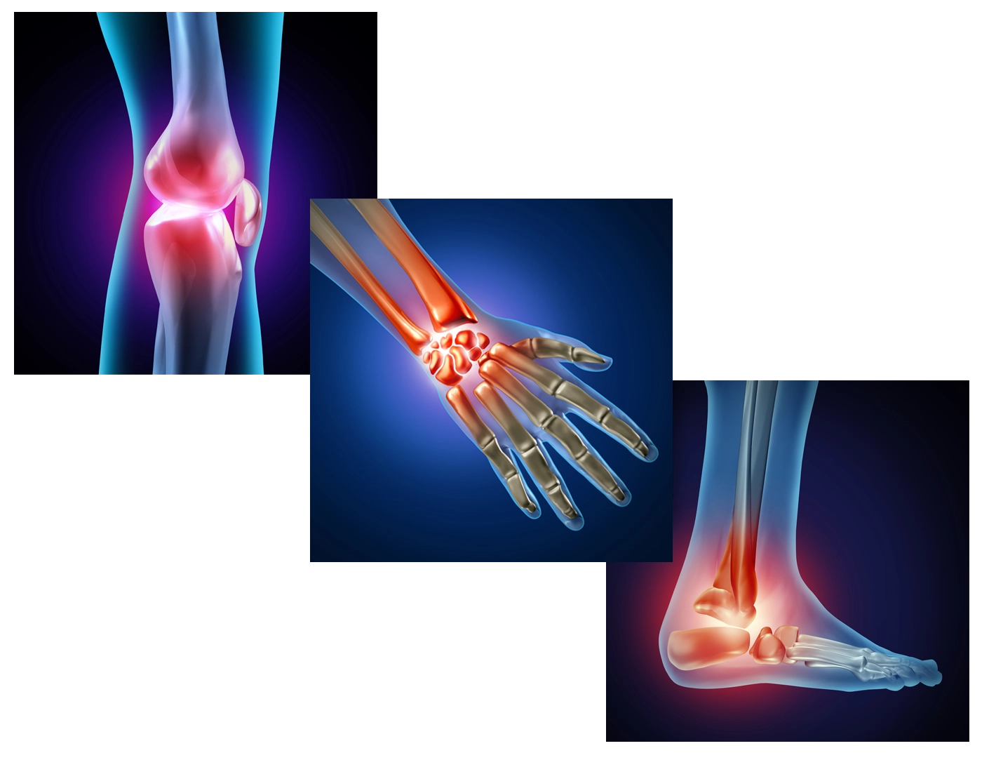 Chronic Pain West Des Moines IA Joint Pain Knee Hand Foot